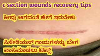 ಸಿಸೇರಿಯನ್ ಗಾಯಗಳನ್ನು ವಾಸಿ ಮಾಡುವುದು ಹೇಗೆ l c section delivery wounds recovery tips l