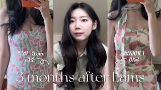 [vlog] 뱃살 빼고 샵사이다 수영복 언박싱ㅣ복부람스 3달차 후기ㅣ만 원 미만 샵사이다 수영복 추천ㅣ지방추출주사 3개월차