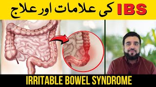 Irritable Bowel Syndrome: IBS Kia Hai? IBS ki Alamat aur Ilaj | Know the Symptoms & Treatment of IBS