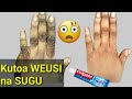 DAWA YA KUTOA WEUSI NA SUGU | How to get rid of DARK KNUCKLES