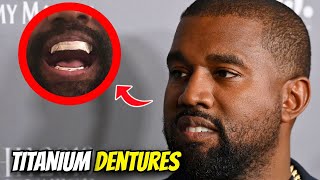Kanye West REPLACES Teeth With Titanium Dentures Worth $850K
