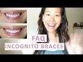 Incognito Lingual Braces FAQ | Everything You Need to Know