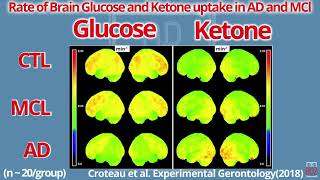 Using Ketones for Brain Function   Dr  Boz annette bosworth-