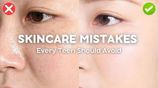 skincare mistakes every teen should avoid 🚫💧 (say goodbye to breakouts!)