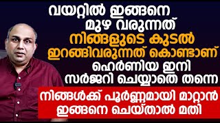 വയറ്റിൽ മുഴവരുന്നത് കുടൽ ഇറങ്ങിവരുന്നത് കൊണ്ടാണ് ഹെർണിയ സർജറി ചെയ്യാതെ മാറ്റാൻ|Hernia Malayalam