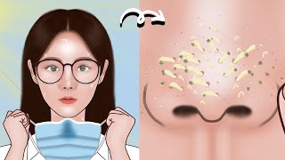 Satisfying  Blackhead Treatment At Home! ASMR skincare animation丨Meng's Stop Mot
