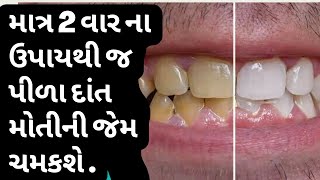 માત્ર 2 જ વાર ના ઉપાયથી પીળા દાંત મોતી ની જેમ ચમકી ઉઠશે | पीले दांतों को सफेद कैसे करे | #पीलेदांत