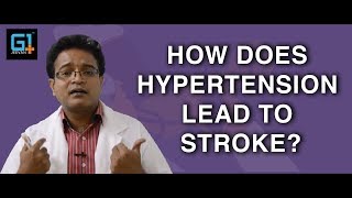How does Hypertension lead to Stroke?