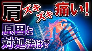 【肩】が ズキズキ 痛い！原因は？痛みを和らげる方法 ！腱板断裂・五十肩・石灰沈着性腱板炎・がん