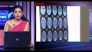 ഏഴ് വയസുകാരന് മസ്തിഷ്‌ക മരണം സംഭവിച്ചെന്ന് സ്ഥിരീകരിക്കാന്‍ ആയിട്ടില്ലെന്ന് വിദഗ്ധ സംഘം