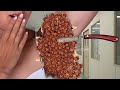 asmr deep cleaning animation asmr maggot and ticks removal animation