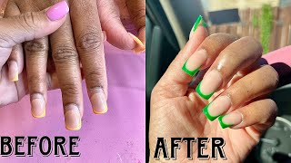 Fill In A 39 Day Old Acrylic Set| Green French Tips 💚