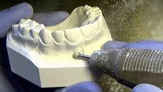 Diagnostik-Modelle bearbeiten und polieren. Dental Models Finishing and Polishing.