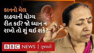 How to Safely Clean Your Ears? કાનનો મેલ કાઢવાની ખરેખર યોગ્ય રીત કઈ છે?