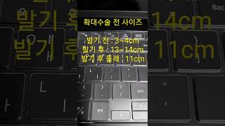 남성확대수술 후기 1편