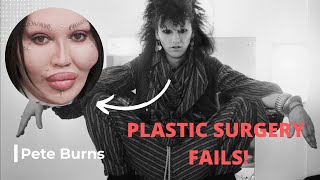 15 Celebrity Plastic Surgery FAILS! (Pete Burns, Katie Price, Farrah Abraham, Amanda Lepore & MORE!)