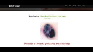 Skin Cancer Prediction Using Deep Learning Techniques | Python Machine Learning IEEE Project