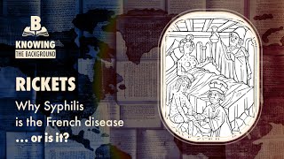 Rickets - Why Syphilis is the 'French disease'… or is it? | Knowing the Background