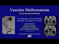 Vascular Malformations by Erik H. Gaensler, M.D.