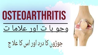 Osteoarthritis - causes, symptoms, diagnosis and treatment|جوڑو ں کا مر ض