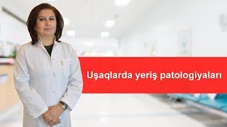 Uşaqlarda yeriş patologiyaları.