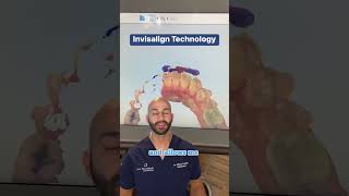 How to Get Started with Invisalign. 2023