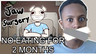 (SomeThingElseYT) I had my jaw wired shut for 2 months - REACTION