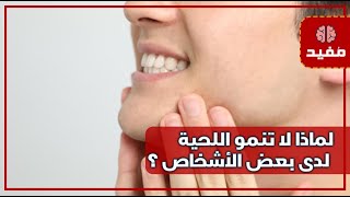 لماذا لا تنمو اللحية لدى بعض الأشخاص ؟