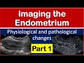 Imaging of the endometrium physiological and pathological changes part 1