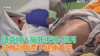 捷克婦人腦死後近4個月　成功剖腹產下健康女嬰｜三立新聞網SETN.com