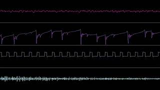 [Amiga] cTrix - Tumble Run (Oscilloscope View)