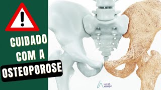 OSTEOPOROSE: Causas, Fatores de Riscos, Tratamento!