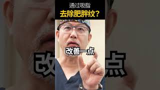 妊娠纹, 肥胖纹 生长纹能通过吸脂去除吗？