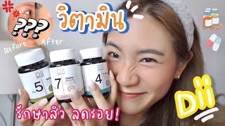 Dii วิตามินอาหารเสริมรักษาสิว รอยสิว ผิวดีขึ้นจริงสิวหายจนต้องบอกต่ออ! | rrommanee