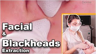 Facial with Steam and BLACKHEAD Removal - professionally done at Dermacure Clinic- Part 1