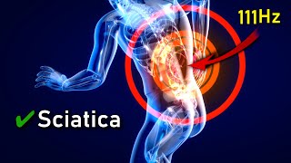 IT'S HERE ❯❯❯ The Sciatica "MIRACLE" Pain Treatment Frequency: Immediate Relief (111Hz)