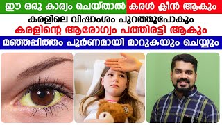 ഈ ഒരു കാര്യം ചെയ്താൽ കരളിലെ വിഷാംശം പുറത്തു പോകും. കരളിന്റെ ആരോഗ്യം പത്തിരട്ടി ആകും | Karal rogam