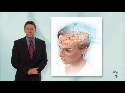 Mayo Clinic Proton Beam Therapy Program - YouTube