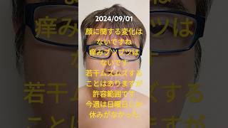 脱塗り薬生活348日目2024/09/01