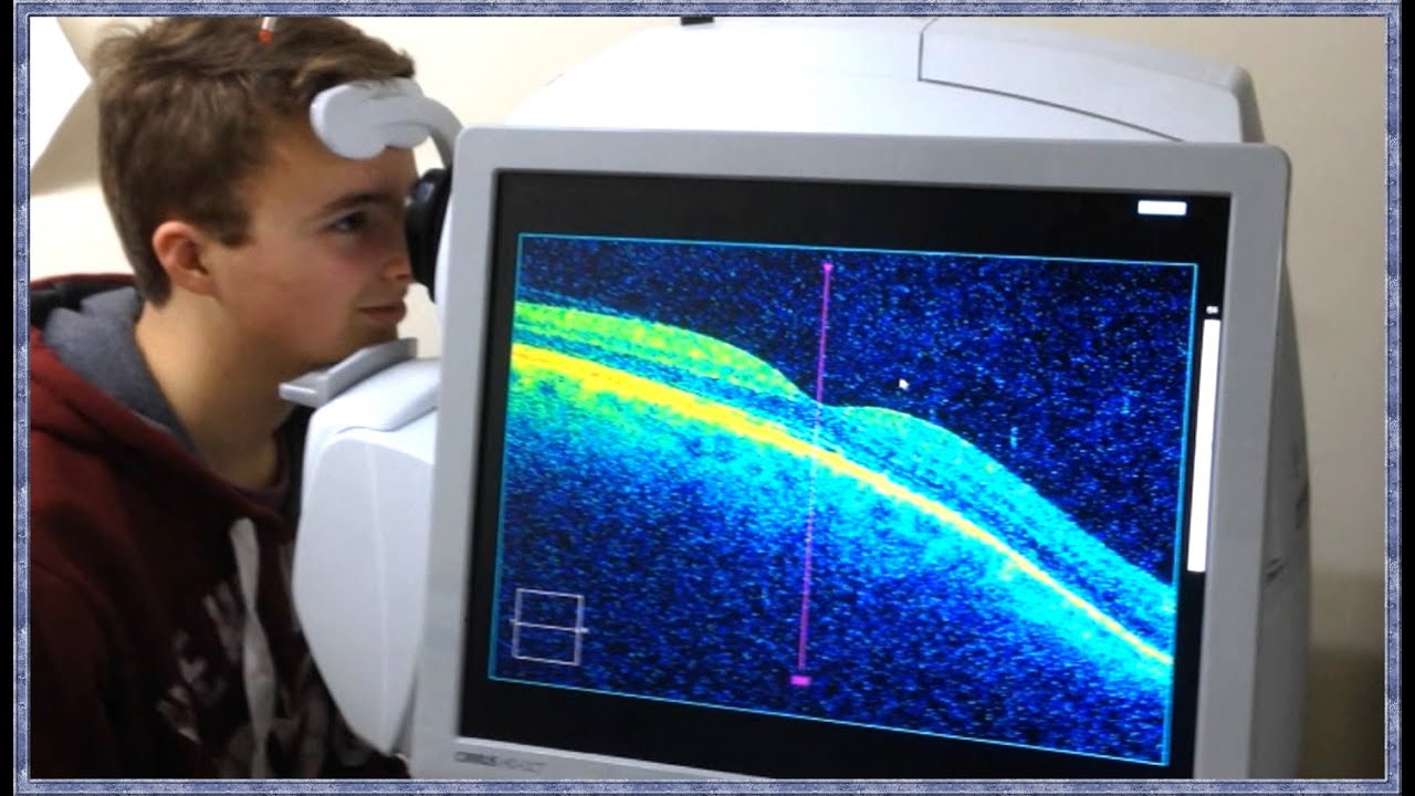 Optical Coherence Tomography Laser Scientist