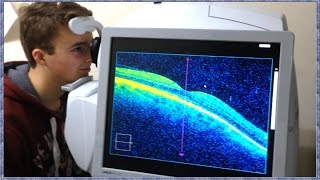What is OCT Scanning? (Optical Coherence Tomography) What is OCT Scanning? (Optical Coherence Tomography)