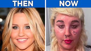 From Beautiful to Unrecognizable… Shocking Celebrity Transformations!