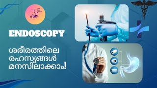 എൻഡോസ്കോപ്പി  - അറിയേണ്ടതെല്ലാം (Endoscopy: Everything You Need to Know)