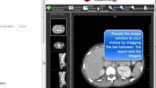 Medinexus - Best Practice - View reports, key images and the full set of images