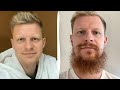 I took a photo every day for 1 year ! Beard Transformation