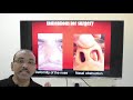 Nasal bone fracture (English) Patient teaching programme