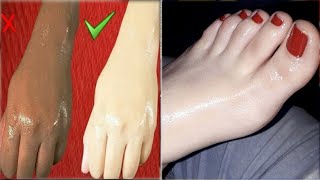 हाथ पैरों के पुराने से पुराने कालापन हटाकर गोरा बना देगा ये नुस्खा/Gora hone ka tarika, fair skin