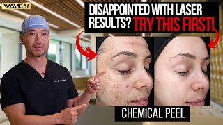 No Results After Laser? Try This Game-Changing Facial!!