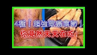 醫生絕對不會吃的4種「超強致癌食物」，99％的人竟然天天在吃！尤其是最後一種！