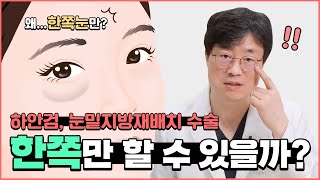 한쪽 눈밑만 불룩한 사람✋!! 하안검, 눈밑지방재배치 꼭 양쪽 다 해야하나요? 눈짝짝이 한쪽만 가능..? (양연모성형외과 | 의학박사 양연모)